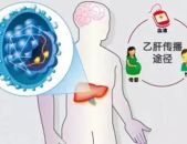 乙肝 症状,揭秘身体发出的健康警报